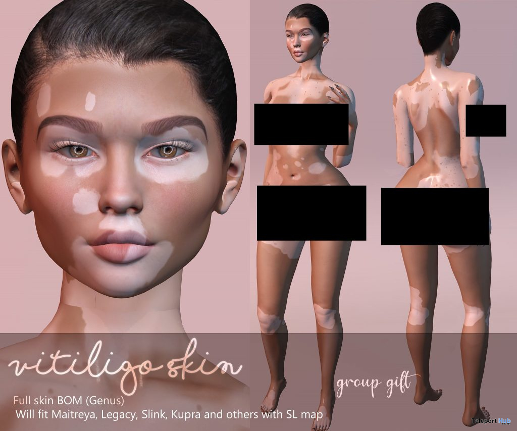 Vitiligo Full BOM Skin February 2021 Group Gift by Mignonne - Teleport Hub - teleporthub.com